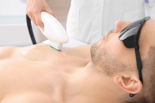 5 Facts Men Need to Know About Laser Chest Hair Removal