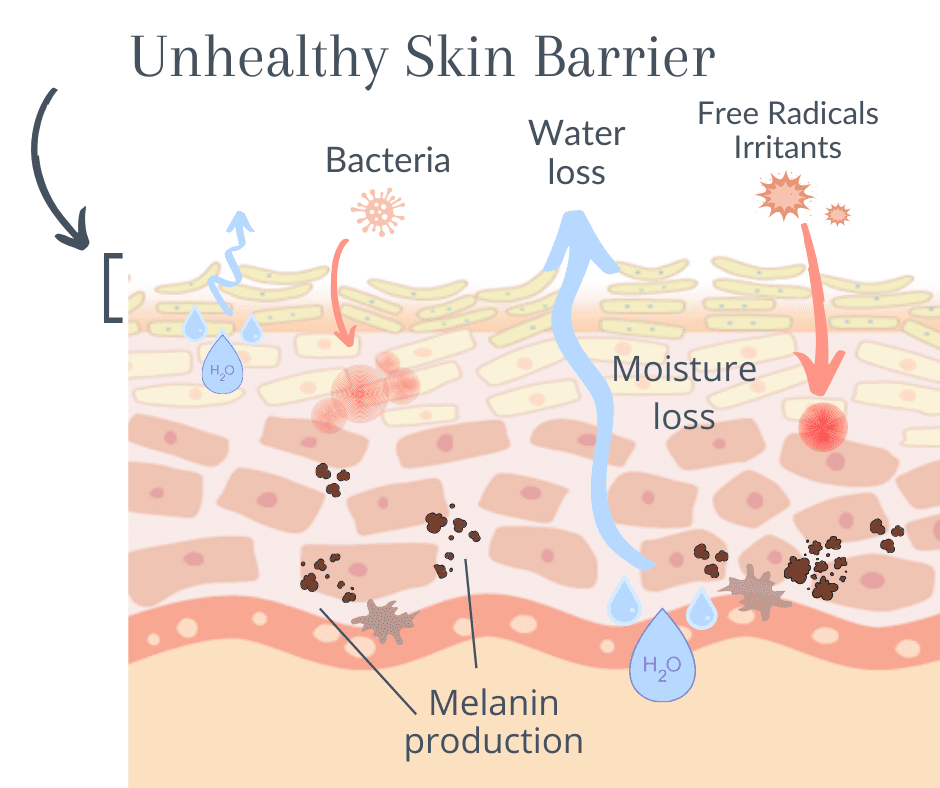 skin-barrier-beautystorygr